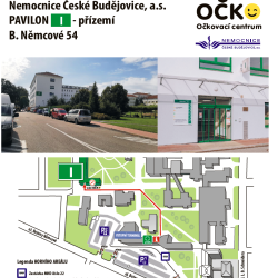 Na začátku října bude zprovozněno dočasné miniOČKO v ambulancích v přízemí pavilonu I (budova bývalé interny) Nemocnice České Budějovice, a.s..